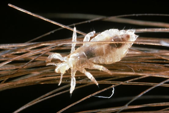 Facts about Head Lice